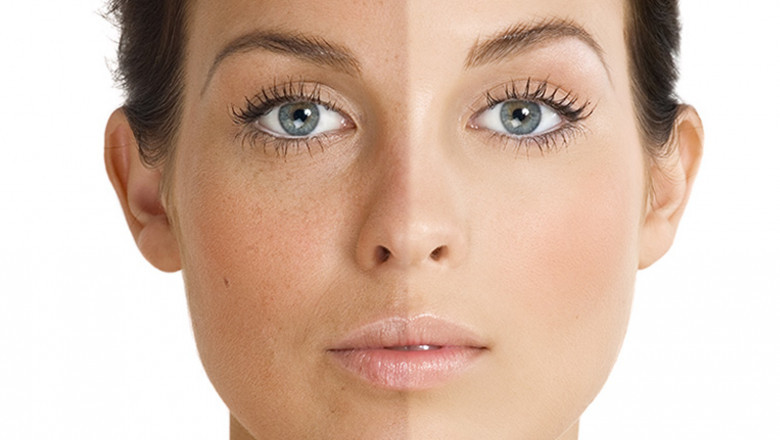 Anti-Wrinkle Patches Market Intelligence: Insights into Trends, Growth Potential, and Consumer Behavior