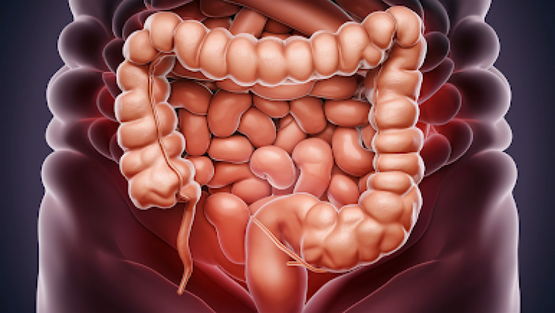 Having Crohn's Means Being Ready for Any Unexpected Situation – Alma Felix