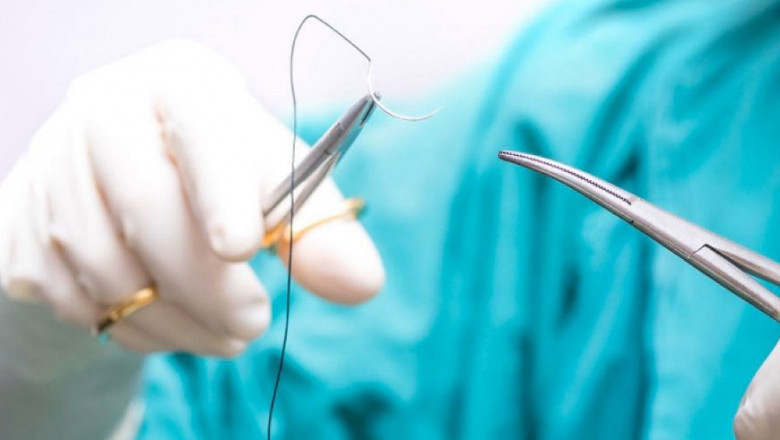 Surgical Sutures Market Trends: Exploring Shifts Toward Biodegradable and Antibacterial Suture Materials Globally