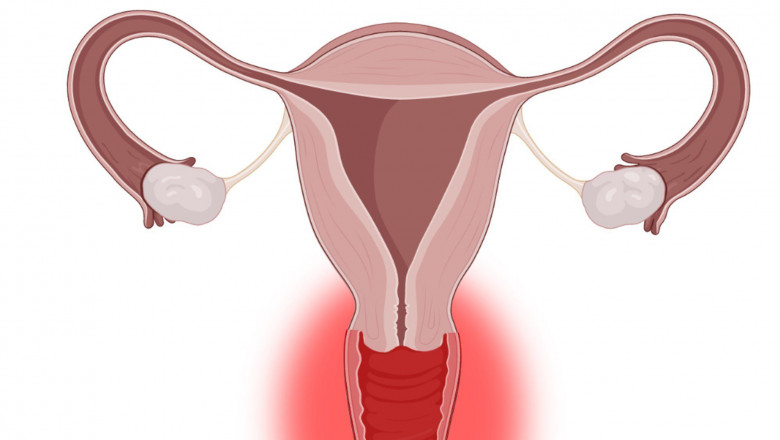 Vaginitis: Causes, Symptoms, Western and Holistic Treatments - Philadelphia Holistic Clinic