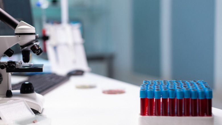 What to Expect During Your First STD Test