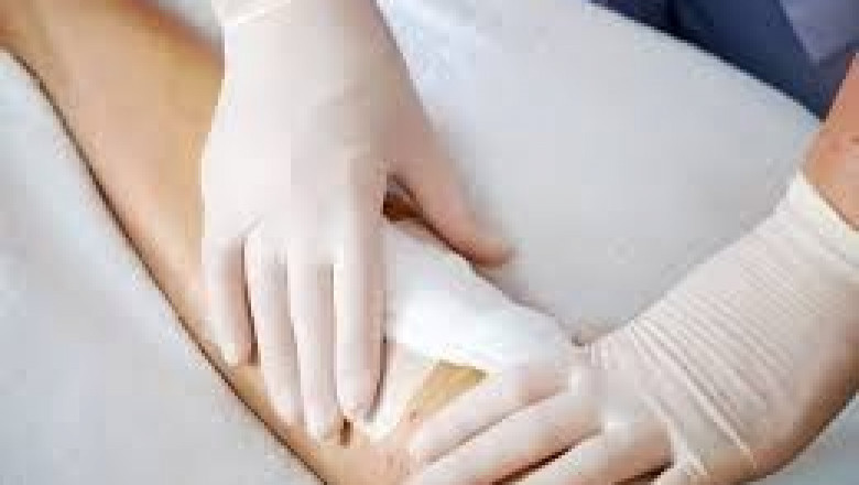 Advanced Wound Management and the Rising Demand for Surgical Dressings