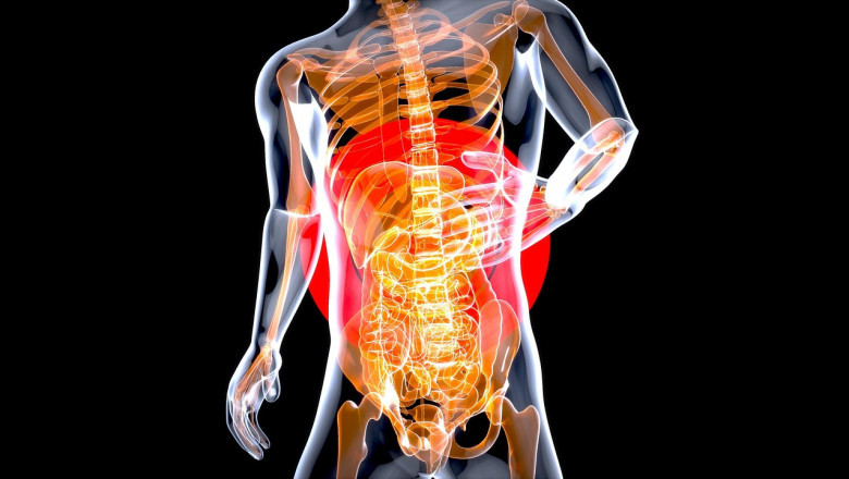 Intrahepatic Cholangiocarcinoma Market to Surge Owing to Targeted Therapies