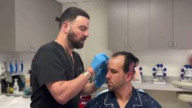 2025 Guide to the Best Hair Transplant Clinics in Beverly Hills