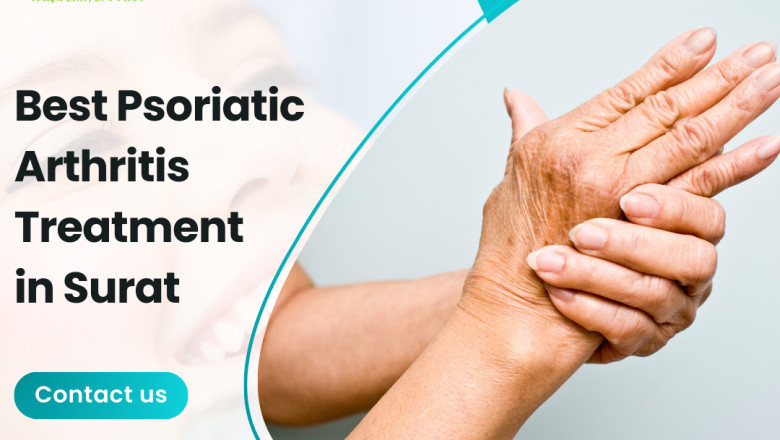 Are there affordable treatment options for Psoriatic Arthritis in Surat