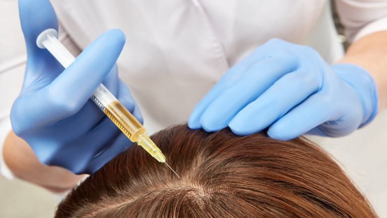 Can PRP Hair Therapy Help With Receding Hairlines?