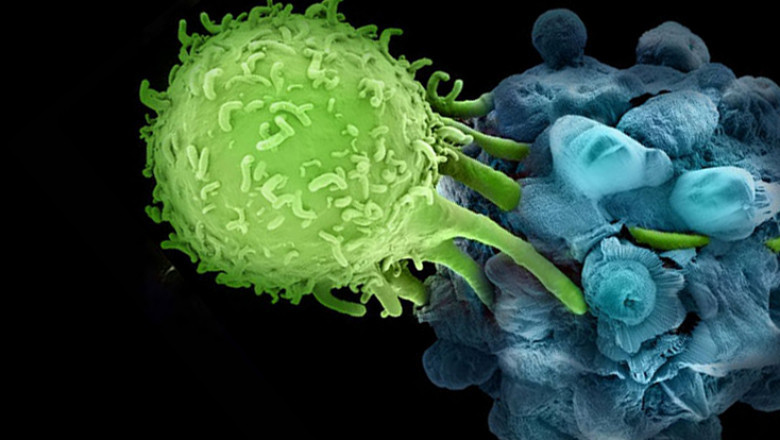 Neuroblastoma Therapeutic Market Poised for Growth Through Innovative Therapies