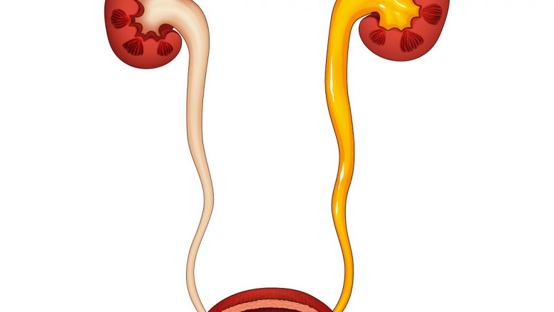 Vesicoureteral Reflux in Children: Diagnosis, Risks, and Surgical Treatment in Delhi