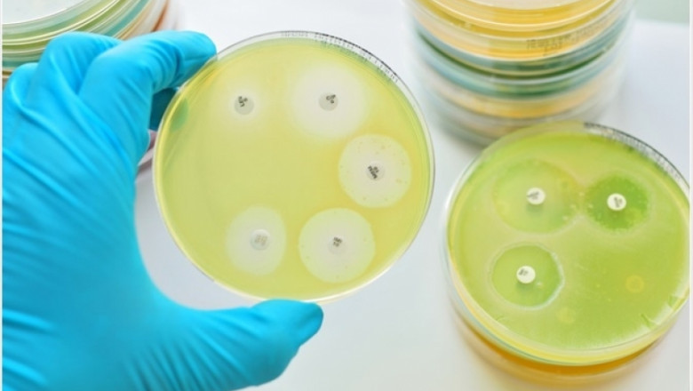 Antimicrobial Susceptibility Test Market Impacting Factors: Regulatory Changes and Rising Antibiotic Resistance Fueling Market Expansion