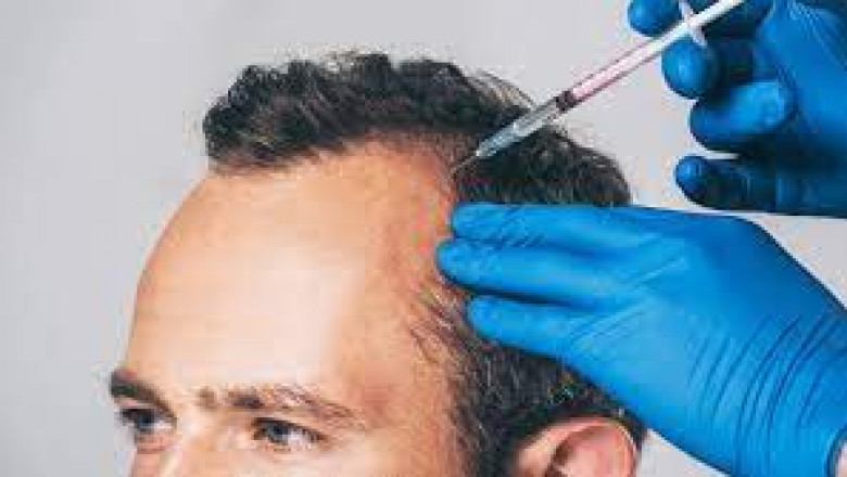 Can PRP Be Combined With Other Cosmetic Procedures?
