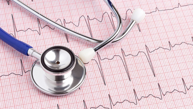 Cardiology Electrodes Market to Gain with Wireless Connectivity