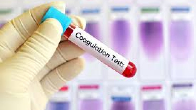 COAGULATION TESTING Market Report: Unlocking Growth Potential and Addressing Challenges