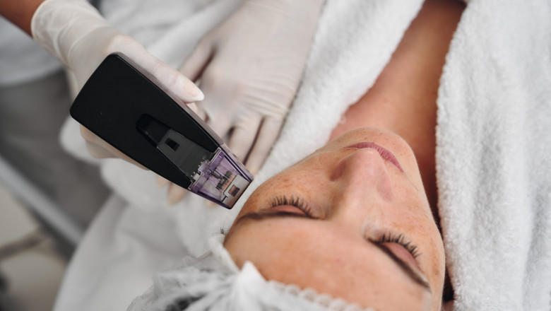 Get Instant Skin Lift and Firmness with Morpheus8 Treatment