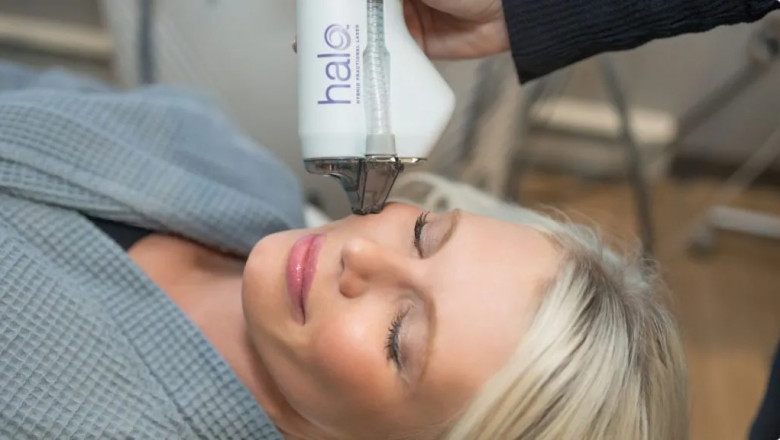Halo Laser Treatment in Fargo, ND | Altaire Clinic
