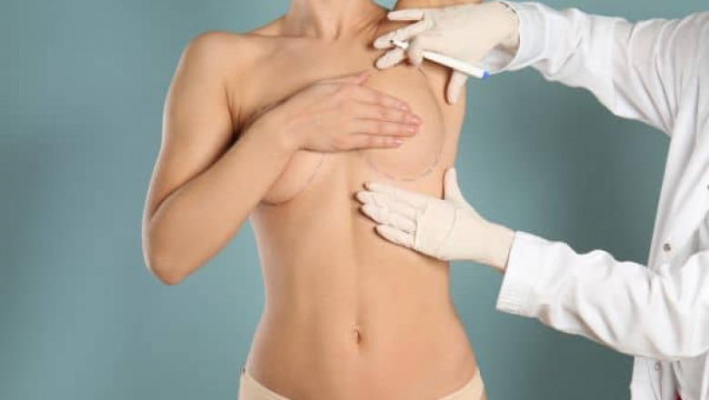 Key Signs You May Be Ready for a Breast Lift Procedure