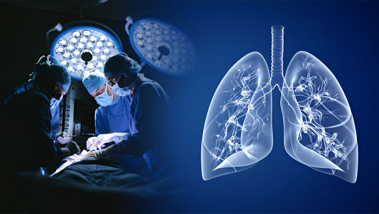 What Are the Steps to Use Stem Cells to Treat Lung Disease?