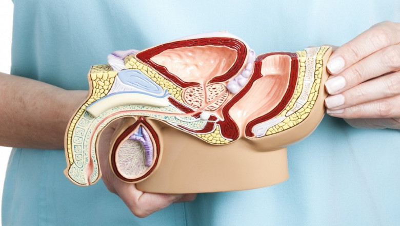 Exploring the Latest Advancements in Peyronies Disease Treatment