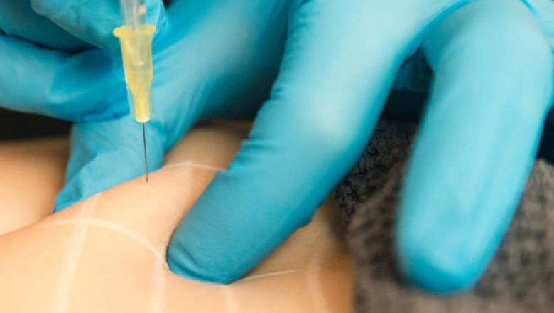 Fat Melting Injection Helps You Finally Lose Stubborn Fat Areas Easily
