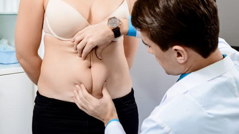 How a Tummy Tuck Shapes Your Midsection