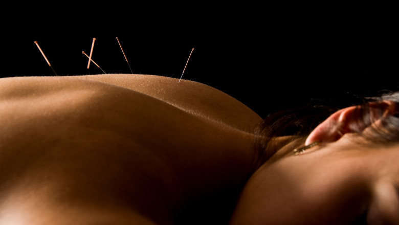 How Acupuncture Points for Fertility Can Aid Reproductive Wellness: A Natural Solution in Denver