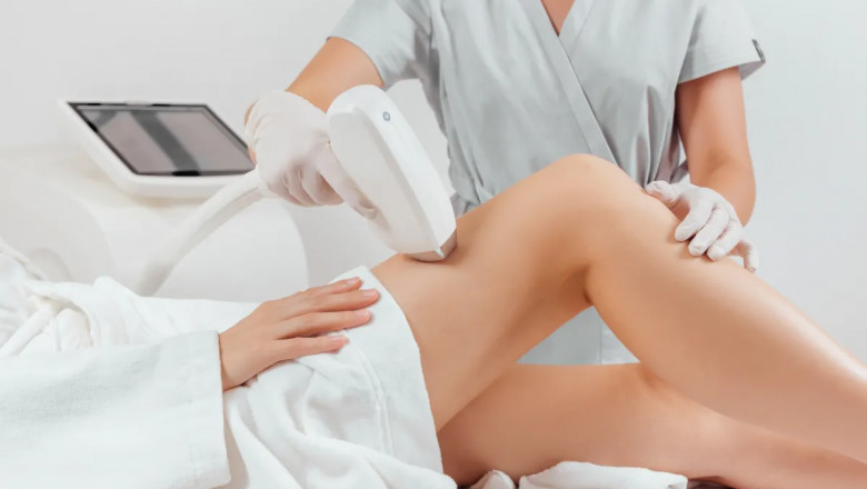 Laser Treatment Costs Unveiled: How to Plan Your Skin Care Budget