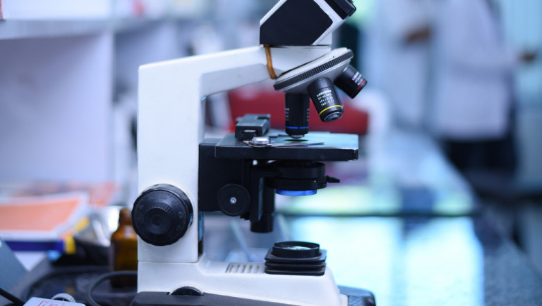 Liver Function Test (LFT)