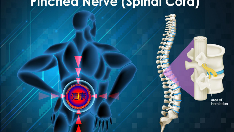 Spinal Stenosis: Natural Treatment at the Philadelphia Holistic Clinic