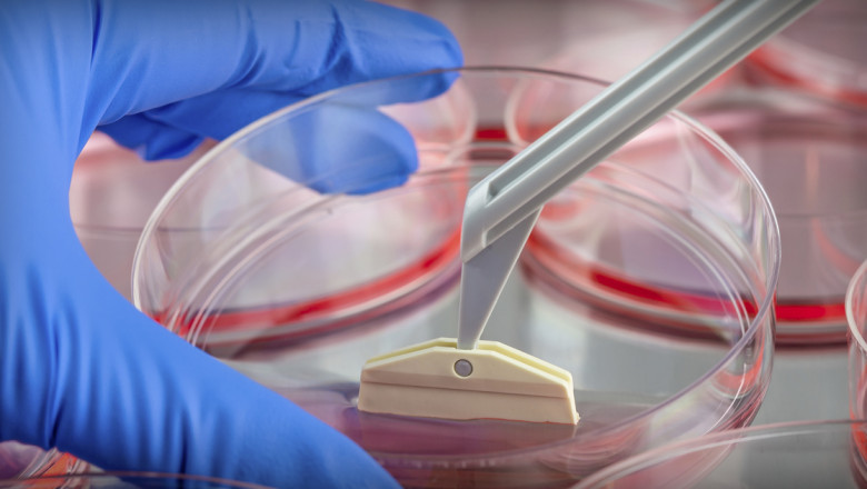 Tissue Transplantation Products and Services: Revolutionizing Medical Treatments