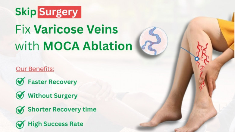 Best Doctor for Varicose Veins Treatment in Mohali, Panchkula &amp; Chandigarh | Varicose Veins Specialist Zirakpur– IRFacilities