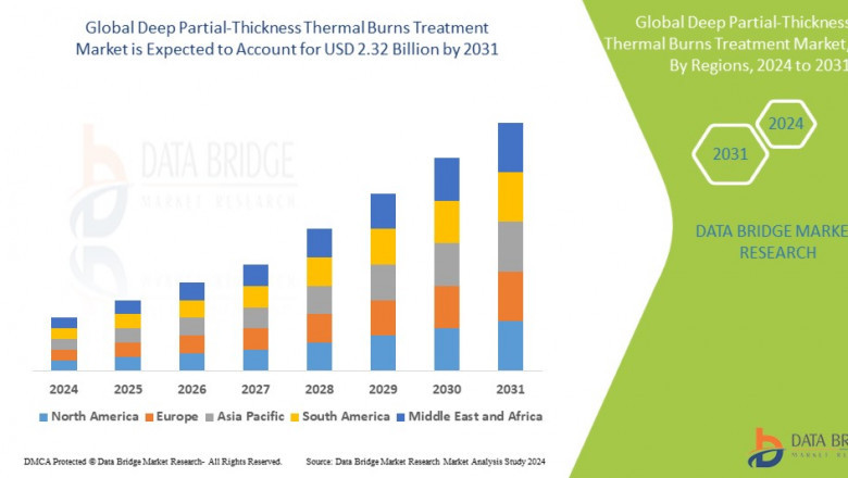 Frozen Snack Food Market growth at a rate of 17.70% in the forecast period of 2021 to 2028