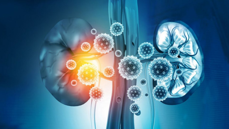 Future Trends in Renal Insufficiency: Market Expansion and Therapeutic Breakthroughs