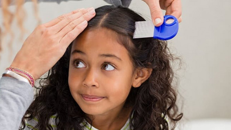 The Only Guide You’ll Ever Need for your lice treatment!