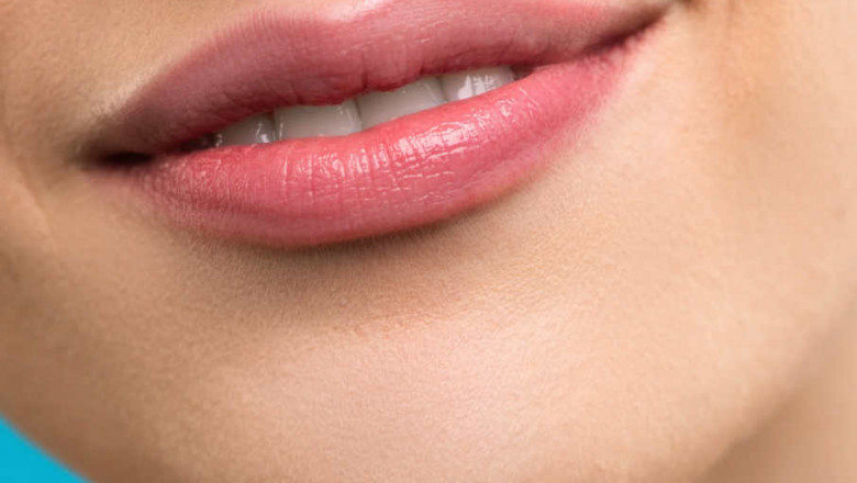 Why More Brides in Islamabad Are Choosing Lip Fillers