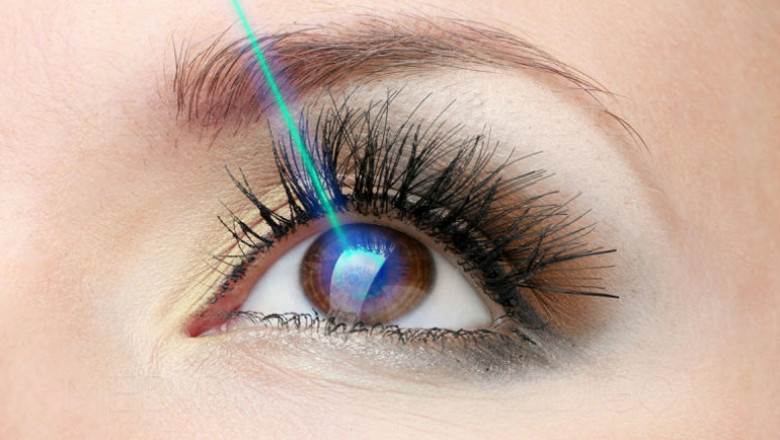 LASIK Eye Surgery Market Thrives as Innovation Enhances Safety Efficiency and Patient Satisfaction