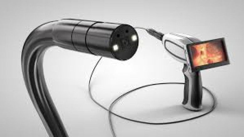Medical Camera Market: Accelerators Driving Rapid Global Growth