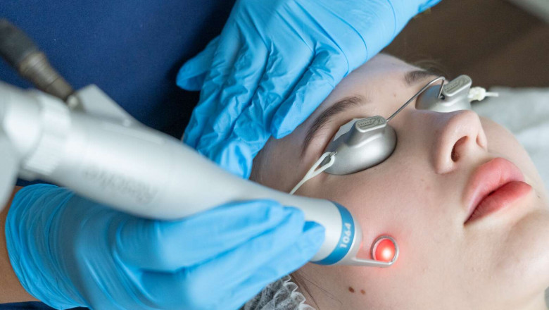 Skin Smoothening with Pico Laser: A Breakthrough