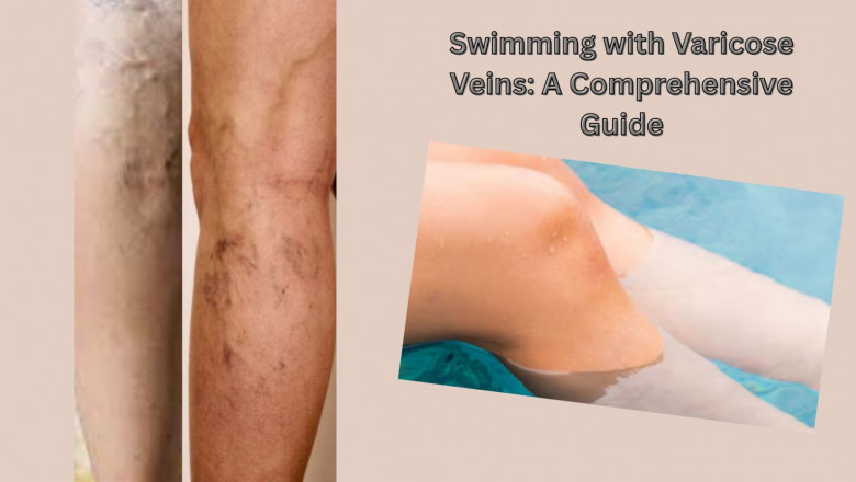 Swimming with Varicose Veins: A Comprehensive Guide