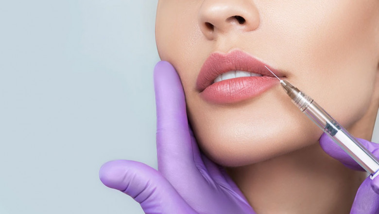 Juvederm Filler Treatment Overview
