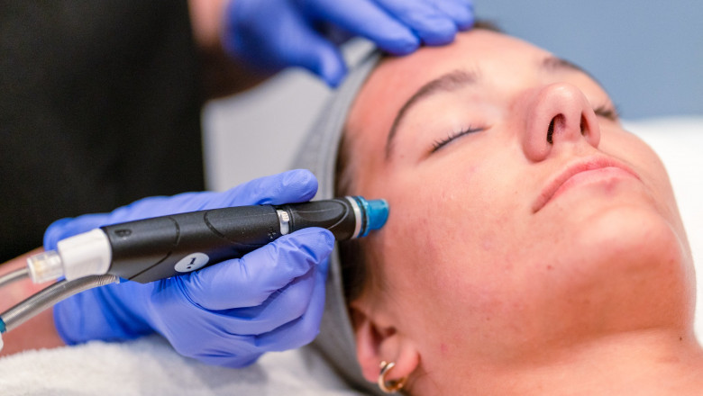 Look Radiant Every Day With Hydrafacial Treatment Magic