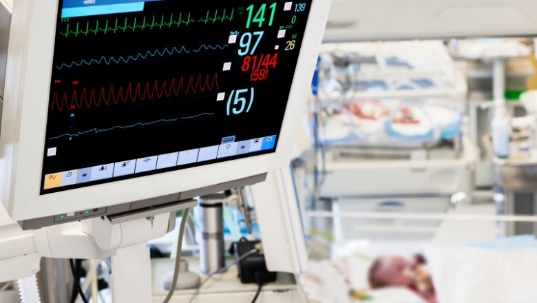 Neonatal Monitoring Equipment Market Analysis and Forecasts Across Major Global Regions and Segments