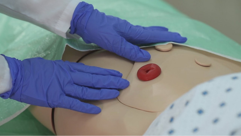 OstomyStoma Care Market Expands Globally Amid Growing Surgical Interventions and Chronic Conditions