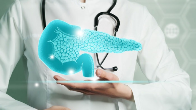 Pancreatic Cancer Treatment in Delhi: Early Detection, Advanced Care, and Hope