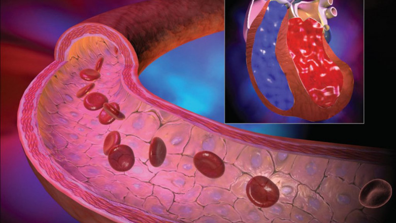 Pulmonary Hypertension Drugs Market to Grow Owing to Innovative Therapeutics
