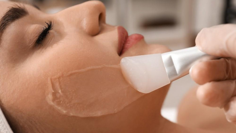 Say Goodbye to Dull Skin: Discover the Glow of a Chemical Peel