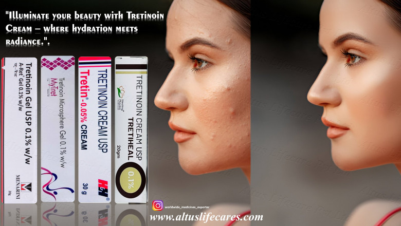 Understanding the Benefits and Proper Use of Tretinoin Cream