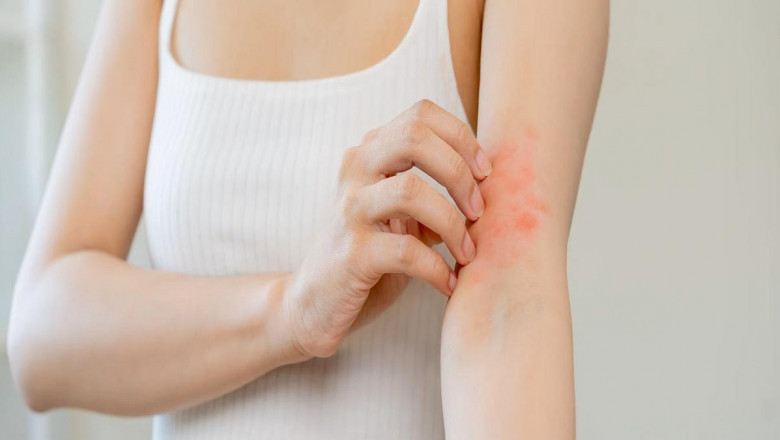 Canine Atopic Dermatitis Treatment Drugs Market Set to Surge with Biologic Innovations