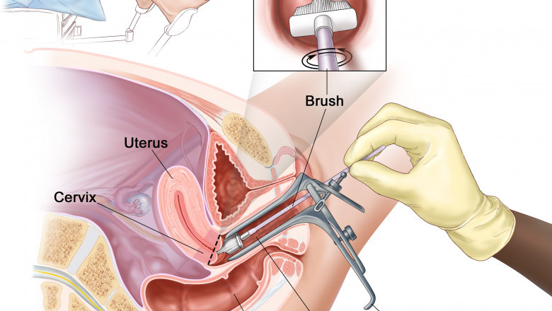 Exploring Global HPV Testing and Pap Test Market Size with Demand and Regional Insights
