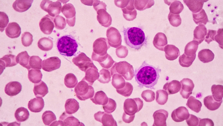 Idiopathic CD4+ Lymphocytopenia Market to Surge with R&D in Immunotherapies