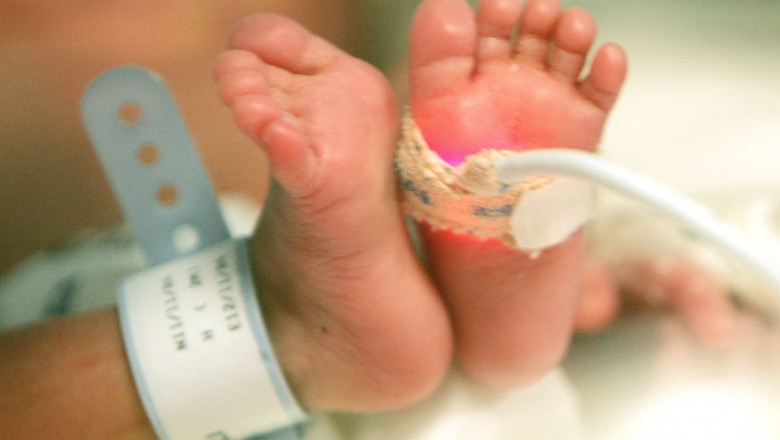 Preterm Births and PROM Testing Market Grows Amid Increasing Global Awareness and Healthcare Investment