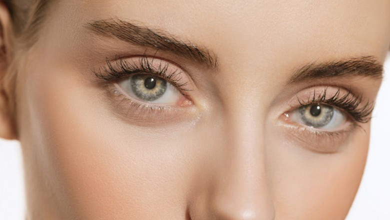 What Makes Under Eye Filler the Go-To Solution for Tired Eyes